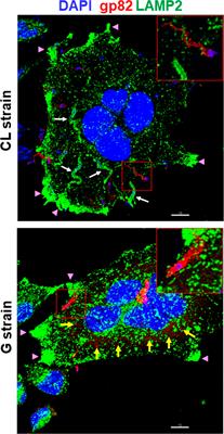 Shedding of Trypanosoma cruzi Surface Molecules That Regulate Host Cell Invasion Involves Phospholipase C and Increases Upon Sterol Depletion